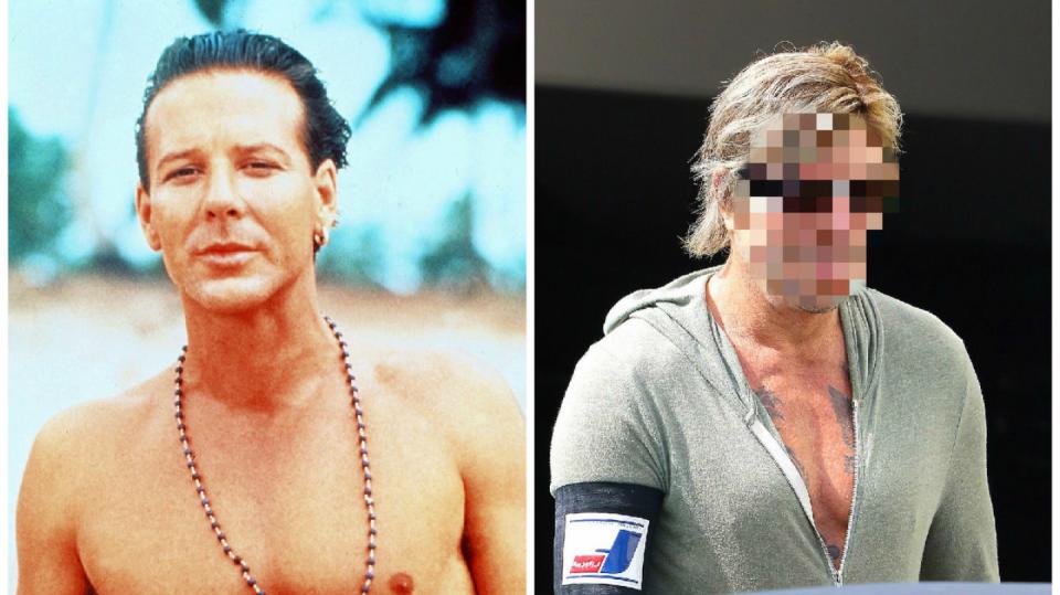 Mickey Rourke šel na plastiku a není vůbec k poznání.